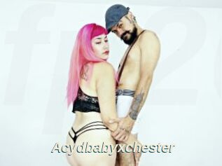 Acydbabyxchester