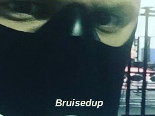 Bruisedup