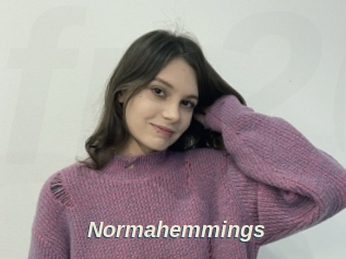 Normahemmings